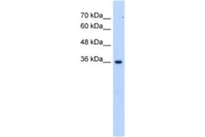 Western Blotting (WB) image for anti-Asparagine-Linked Glycosylation 1 Homolog Pseudogene (ALG1L6P) antibody (ABIN2463268) (ALG1L6P anticorps)