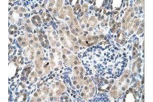 Image no. 1 for anti-Solute Carrier Family 19 (Folate Transporter), Member 1 (SLC19A1) (N-Term) antibody (ABIN205031)