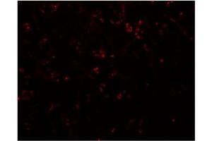 Immunofluorescence of SYNPO in human brain tissue with SYNPO Antibody  at 20 μg/ml. (SYNPO anticorps  (C-Term))