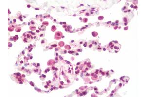Anti-PTF1A antibody IHC staining of human lung. (PTF1A anticorps  (AA 12-43))