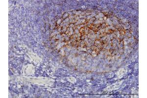 Immunoperoxidase of monoclonal antibody to QPRT on formalin-fixed paraffin-embedded human tonsil.
