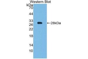 Western Blotting (WB) image for anti-B-Cell CLL/lymphoma 2 (BCL2) (AA 2-211) antibody (ABIN1077852) (Bcl-2 anticorps  (AA 2-211))