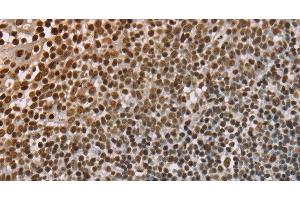 Immunohistochemistry of paraffin-embedded Human tonsil using NUP50 Polyclonal Antibody at dilution of 1:30 (NUP50 anticorps)