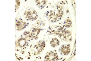 Immunohistochemistry of paraffin-embedded Human mammary gland using PRPF3 antibody at dilution of 1:100 (x400 lens). (PRPF3 anticorps)