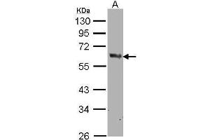 WB Image Sample(30 μg of whole cell lysate) A:MOLT4, 10% SDS PAGE antibody diluted at 1:500 (PTGS1 anticorps  (C-Term))