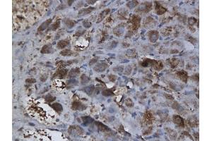 Formalin-fixed and paraffin embedded rat ovary labeled with Anti-CTBP1 Polyclonal Antibody, unconjugated (ABIN686152) followed by incubation with conjugated secondary antibody and DAB staining