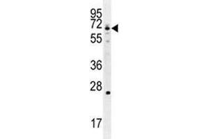 GCLC antibody western blot analysis in Jurkat lysate (GCLC anticorps  (AA 1-30))