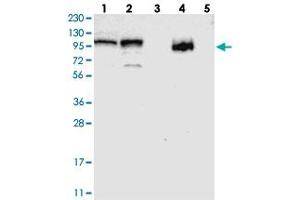 Western blot analysis of Lane 1: RT-4, Lane 2: U-251 MG, Lane 3: Human Plasma, Lane 4: Liver, Lane 5: Tonsil with RBM28 polyclonal antibody . (RBM28 anticorps)