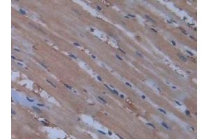 Detection of NOS2 in Rat Heart Tissue using Polyclonal Antibody to Nitric Oxide Synthase 2, Inducible (NOS2)