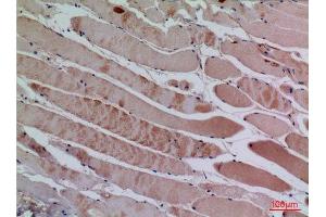 Immunohistochemistry (IHC) analysis of paraffin-embedded Human Muscle, antibody was diluted at 1:100. (CXCL13 anticorps  (Internal Region))