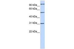 RAI14 antibody used at 1 ug/ml to detect target protein. (RAI14 anticorps  (Middle Region))