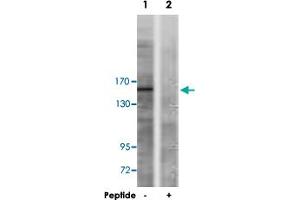 Western blot analysis of extracts from A-549 cells, using TP53BP1 polyclonal antibody .