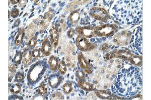 PKLR antibody was used for immunohistochemistry at a concentration of 4-8 ug/ml. (PKLR anticorps  (N-Term))