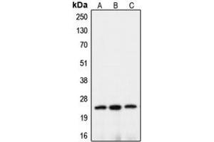 Western blot analysis of Claudin 10 expression in HEK293T (A), mouse brain (B), rat kidney (C) whole cell lysates. (CLDN10 anticorps  (C-Term))
