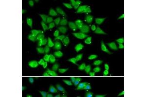 Immunofluorescence analysis of HeLa cells using NFATC3 Polyclonal Antibody (NFATC3 anticorps)