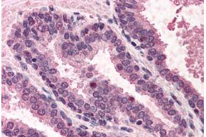 Human Prostate (formalin-fixed, paraffin-embedded) stained with POLK antibody ABIN291099 at 5 ug/ml followed by biotinylated anti-goat IgG secondary antibody ABIN481715, alkaline phosphatase-streptavidin and chromogen. (POLK anticorps  (AA 817-830))