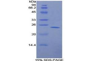 SDS-PAGE analysis of Human LMP7 Protein.