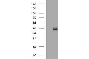 Image no. 1 for anti-Fatty Acid 2-Hydroxylase (FA2H) antibody (ABIN1500829) (FA2H anticorps)