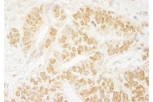 anti-PAXIP1 Associated Glutamate-Rich Protein 1 (PAGR1) (AA 204-254) antibody