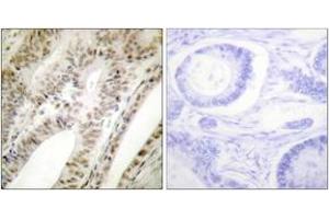 Immunohistochemistry analysis of paraffin-embedded human tonsil tissue, using PML Antibody.