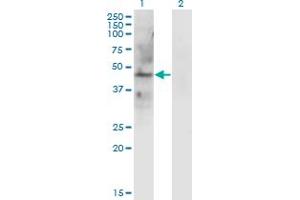 Western Blot analysis of LAMP2 expression in transfected 293T cell line by LAMP2 monoclonal antibody (M01), clone 2G10. (LAMP2 anticorps  (AA 30-127))