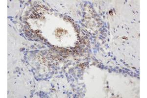 Image no. 2 for anti-Glyceraldehyde-3-Phosphate Dehydrogenase, Spermatogenic (GAPDHS) antibody (ABIN1498375) (GAPDHS anticorps)