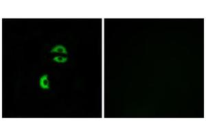 Immunofluorescence analysis of A549 cells, using LDLRAD3 antibody. (LDLRAD3 anticorps  (Internal Region))