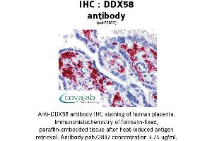 Image no. 2 for anti-DEAD (Asp-Glu-Ala-Asp) Box Polypeptide 58 (DDX58) antibody (ABIN1733572) (DDX58 anticorps)