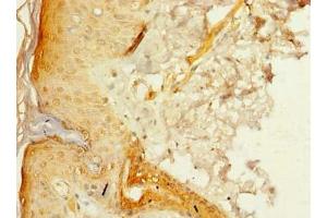 Immunohistochemistry of paraffin-embedded human skin tissue using ABIN7175005 at dilution of 1:100 (MRPL46 anticorps  (AA 28-153))
