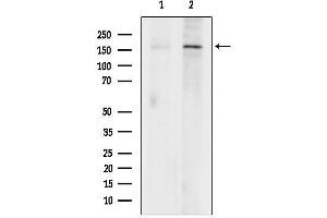 anti-Lysine (K)-Specific Demethylase 5C (KDM5C) (C-Term) antibody