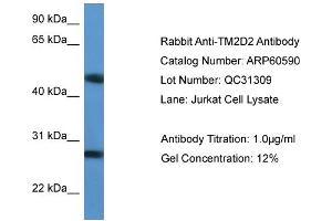 WB Suggested Anti-TM2D2  Antibody Titration: 0. (TM2D2 anticorps  (Middle Region))