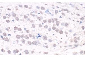 Immunohistochemistry (IHC) image for anti-AT Rich Interactive Domain 2 (ARID, RFX-Like) (ARID2) (AA 1785-1835) antibody (ABIN7448417)