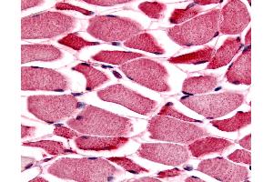 Anti-PYGM / Phosphorylase b antibody IHC of human skeletal muscle.