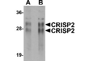 Western Blotting (WB) image for anti-Cysteine-Rich Secretory Protein 2 (CRISP2) (N-Term) antibody (ABIN1031327) (CRISP2 anticorps  (N-Term))