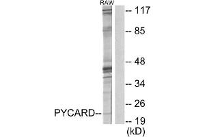 Western blot analysis of extracts from RAW264. (STS anticorps  (N-Term))