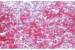 Human Tonsil: Formalin-Fixed, Paraffin-Embedded (FFPE)