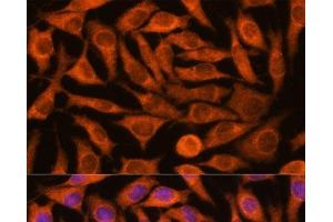 Immunofluorescence analysis of L929 cells using NDUFAF4 Polyclonal Antibody at dilution of 1:100.