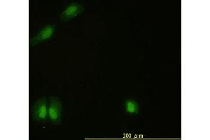 Immunofluorescence of monoclonal antibody to CAMK4 on HeLa cell. (CAMK4 anticorps  (AA 1-473))
