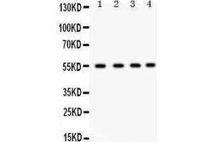 Western Blotting (WB) image for anti-Gap Junction Protein, alpha 3, 46kDa (GJA3) (AA 89-118), (N-Term) antibody (ABIN3042423) (GJA3 anticorps  (N-Term))