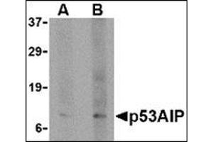 Western blot analysis of p53AIP1 in HL60 cell lysate with this product at (A) 4 and (B) 8 μg/ml. (TP53AIP1 anticorps  (N-Term))