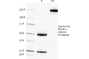 SDS-PAGE Analysis Purified Adipophilin Mouse Monoclonal Antibody (ADFP/1494). (ADRP anticorps  (AA 249-376))