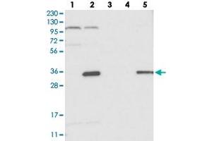 Western blot analysis of Lane 1: RT-4, Lane 2: U-251 MG, Lane 3: Human Plasma, Lane 4: Liver, Lane 5: Tonsil with C14orf94 polyclonal antibody . (C14orf94 anticorps)