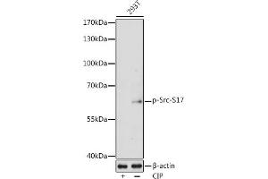 Western blot analysis of extracts of 293T cells, using Phospho-Src-S17 antibody  at 1:1000 dilution. (Src anticorps  (pSer17))