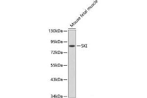 Western blot analysis of extracts of Mouse fetal muscle using SKI Polyclonal Antibody. (SKI anticorps)