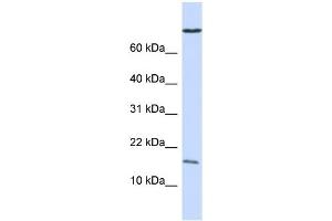 WB Suggested Anti-GABARAP Antibody Titration:  0. (GABARAP anticorps  (N-Term))