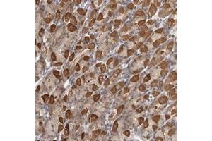 Immunohistochemical staining of human stomach with PARP6 polyclonal antibody  shows strong cytoplasmic positivity in Parietal cells at 1:50-1:200 dilution. (PARP6 anticorps)