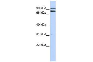 TRIM67 antibody used at 1 ug/ml to detect target protein. (TRIM67 anticorps  (C-Term))