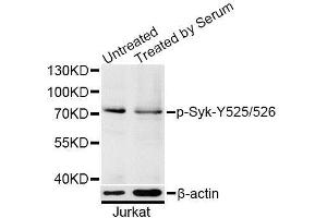 Western blot analysis of extracts of Jurkat cells, using Phospho-Syk-Y525/526 antibody (ABIN5996170) at 1/1000 dilution. (SYK anticorps  (pTyr525, pTyr526))