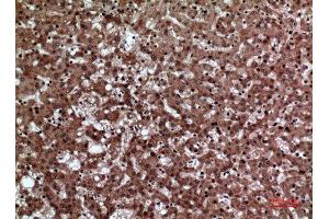 Immunohistochemistry (IHC) analysis of paraffin-embedded Human Liver, antibody was diluted at 1:100.