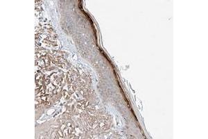 Immunohistochemical staining of human skin with TSR2 polyclonal antibody  shows strong positivity in superficial layers. (TSR2 anticorps)